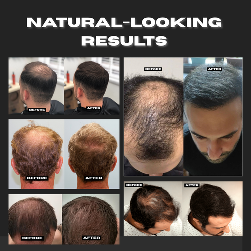 RootdMethod™ Hair Fiber System (Kit)