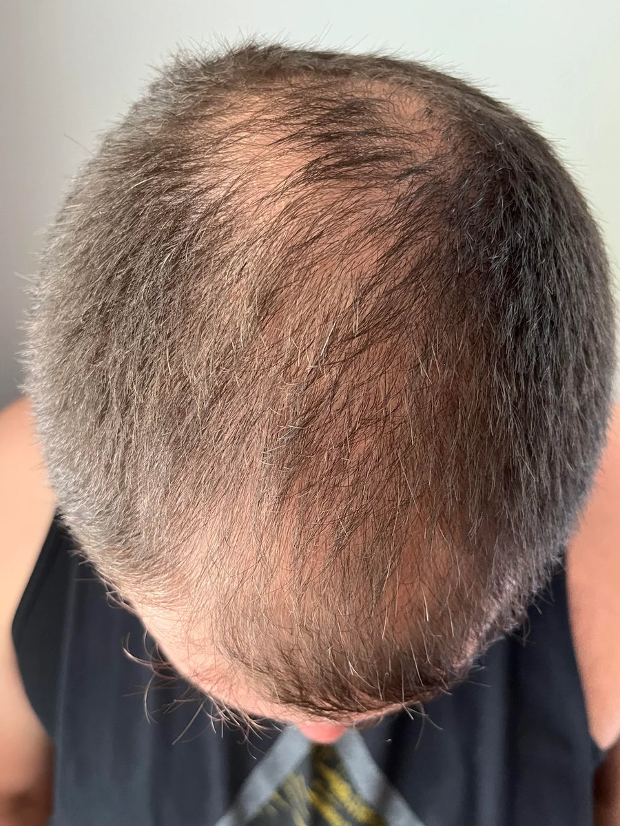 Diffuse Thinning